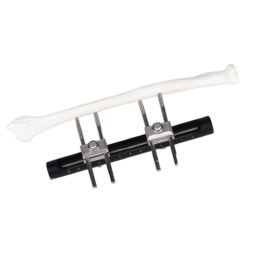 Wrist Joints External Fixator