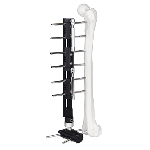 Bone Lengthening External Fixator - Type C