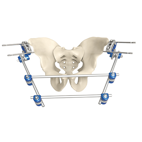 Pelvic External Fixator