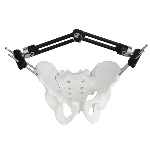 Pelvic Fragment External Fixator - Type B