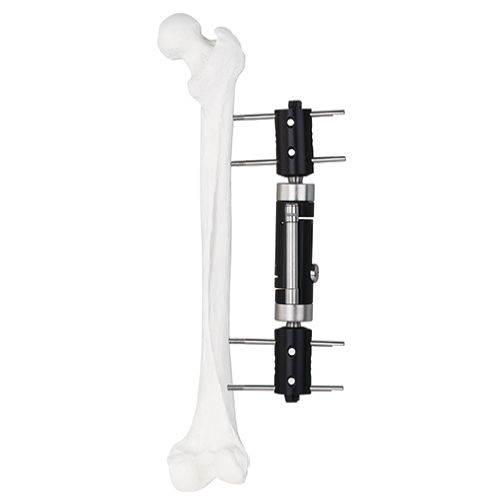 Straight Type External Fixator