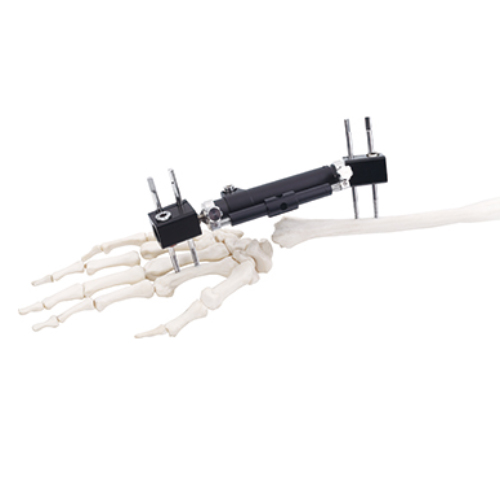 Wrist Joints External Fixator