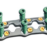 Anterior Cervical Spine Titanium Plate(R-Speedo)II