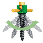 J-Sagacious 5.5 Screw & Rod System