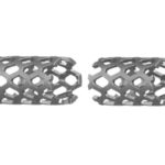 Angled Titanium Mesh