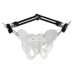 Pelvic Fragment External Fixator - Type B