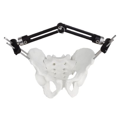 Pelvic Fragment External Fixator – Type B