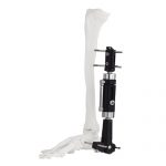 Ankle Joint Fragment External Fixator