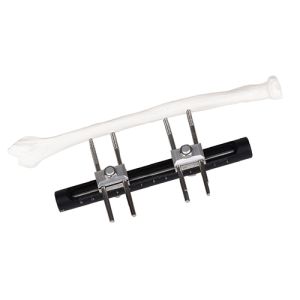 Wrist Joints External Fixator