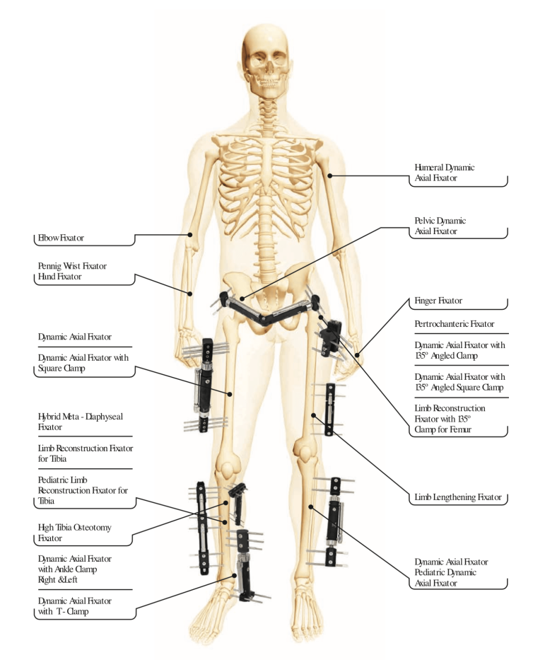orthopromed-external-fixators